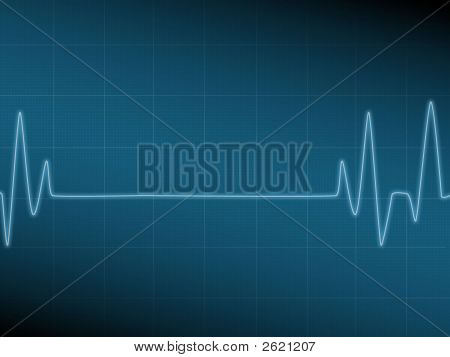 EKG