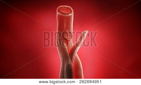 3d rendered medically accurate illustration of a schistosoma