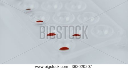 Close-up of blood sample plates. Laboratory researches of blood samples. COVID-19 or coronavirus.