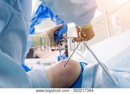 Arthroscope Surgery. Orthopedic Surgeons In Teamwork In The Operating Room