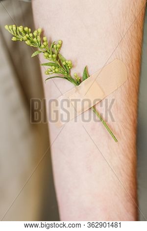A Small Twig Of Yellow Flowers Is Glued To The Male Hand With A Flesh-colored Medical Bactericidal P