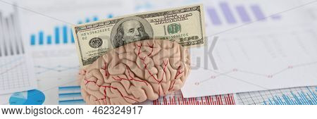 Close-up Of Banknote Fit In Anatomical Model Of Human Brain, Miniature Put On Business Papers. Make 