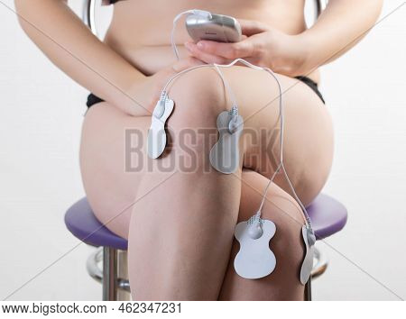 Electrodes Of Modern Acupuncture And Anti-cellulite Massagers On The Legs Of A Girl In Problem Areas