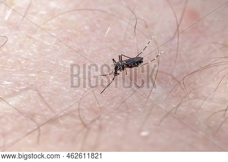 Asian Tiger Mosquito Sucking Blood On Human Skin (albopictus). Close