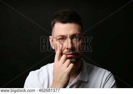 Man Checking His Health Condition On Black Background. Yellow Eyes As Symptom Of Problems With Liver