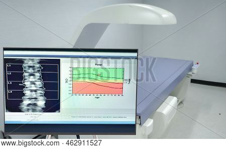 Medical Bone Density Room And Bonedensity Lumbar Spine Report On Computer With Blurry Room Backgroun