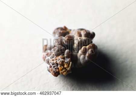 Kidney Stone, Intact, Formed In An Alkaline Environment In The Kidneys After Eswl Intervention Or Su