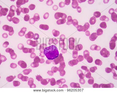 Promyelocyte.