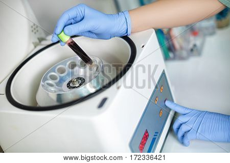 Plasmolifting. Preparation of blood for injections. cosmetologist puts tube of blood in centrifuge for separation processing.