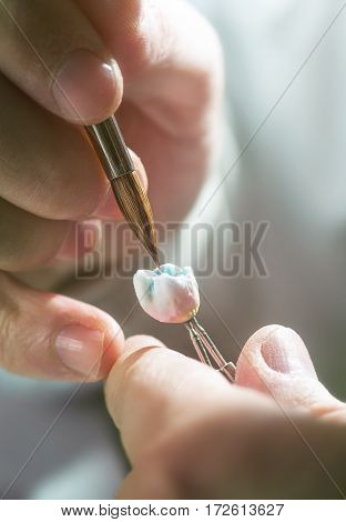 Dental prosthesis artificial tooth prosthetic hands working on the denture false teeth.