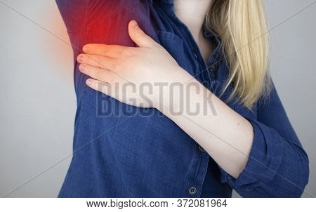 A Woman Suffers From Pain In The Armpit. Sweating, Unpleasant Odor, Redness, Tooth And Inflammation