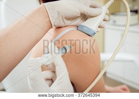 Ultrasound-guided Platelet-rich Plasma Injection Of The Shoulder.