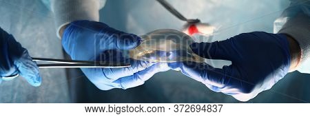 Surgeons Holding Instruments And Breast Implant. Plastic Surgeon Offers Breast Implant Based On His 