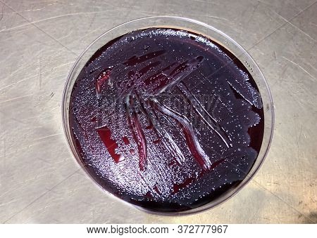 A Petri Dish With Smears To Detect Infections