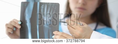 Close-up Of Surgeon Hands Holding Wrist Skiagram. Serious Woman In Medical Uniform Consulting With C