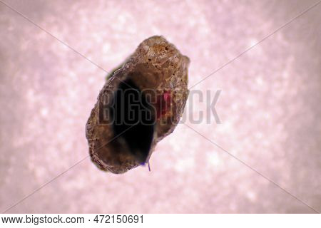 Analysis Of Microplastic Waste Contaminated In Soils And Water. Water Sample Full Of Plastic Particl
