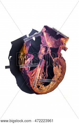 Moscow, Russia - May 05, 2021: Famous Anatomy Exhibition Body Worlds Where Plastinated Bodies Are Ex