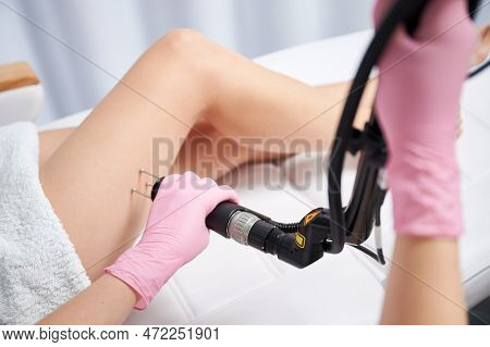 Close Up Of Beautician Hands In Sterile Gloves Using Erbium Ablative Laser Device While Performing L