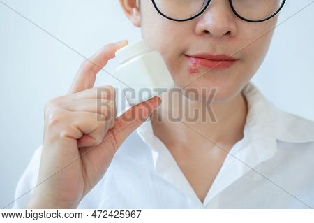 Woman Holding A Vial Before Eating For Treat Herpes Labialis Occur On Her Lower Lip. Blisters That B
