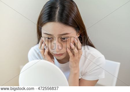 Bored, Insomnia Asian Young Woman, Girl Looking At Mirror, Without Makeup, Touch Under Eyes With Pro