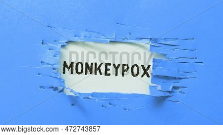 Inspiration Showing Sign Monkeypox. Word For Poxvirus Of Africa Caused By Chiefly In Wild Rodents An