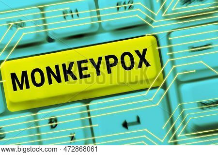 Sign Displaying Monkeypox. Internet Concept Poxvirus Of Africa Caused By Chiefly In Wild Rodents And