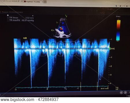 Echocardiogram Colorful Probe Targeting Map And Waveforms