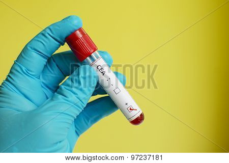 CEA positive