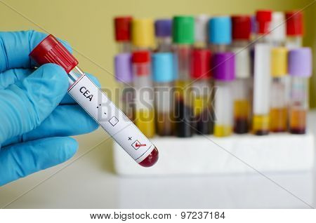 CEA positive
