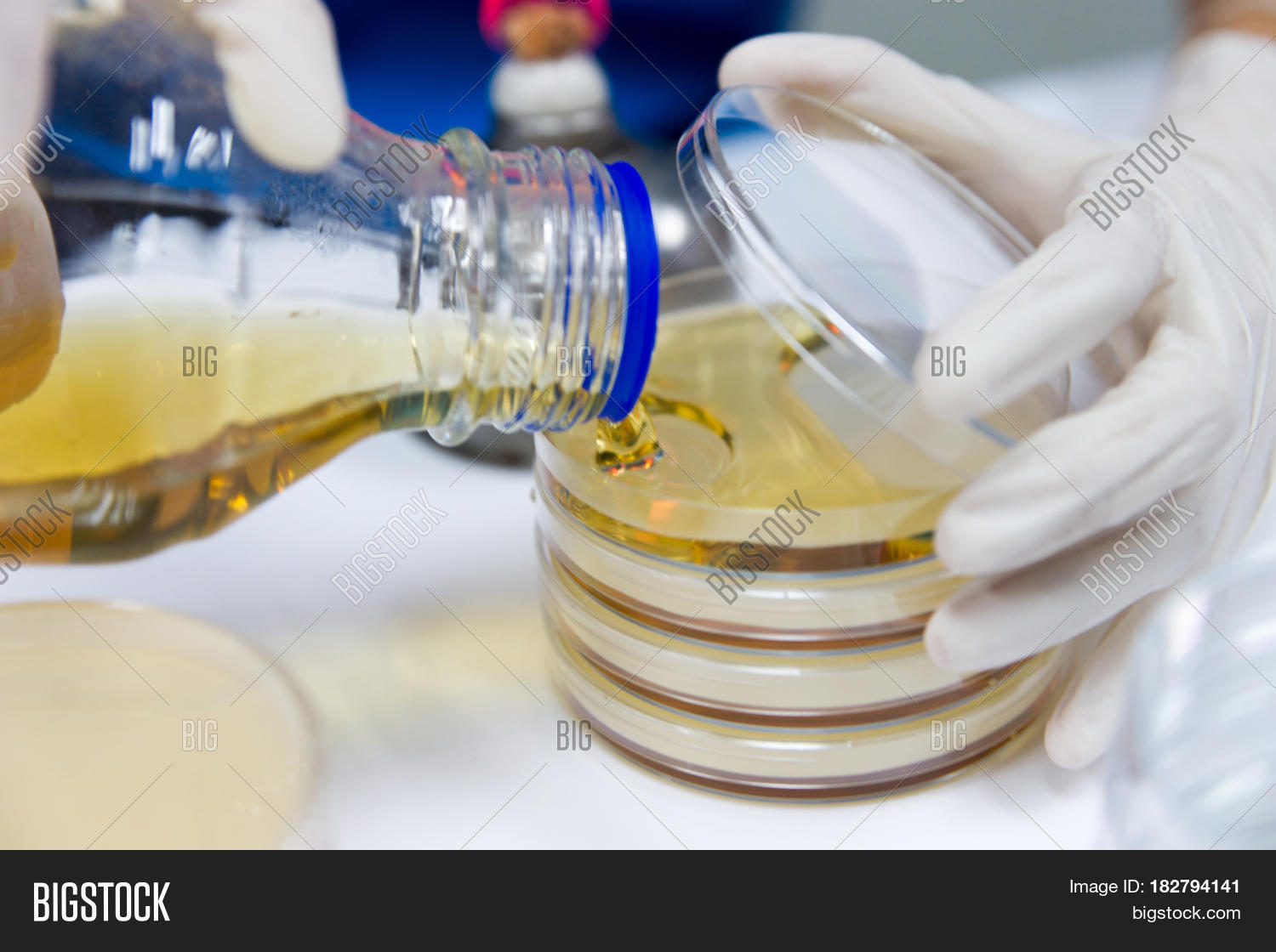 Pour Plate Method Image & Photo (Free Trial) Bigstock