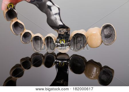 Skeletal Prosthesis -  Art Of Dentsitry