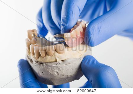 Dentist showing the anchoring mechanism of a dental skeletal prosthesis.