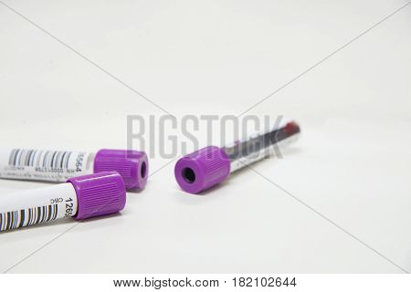 Test tube CBC on white tone in laboratory