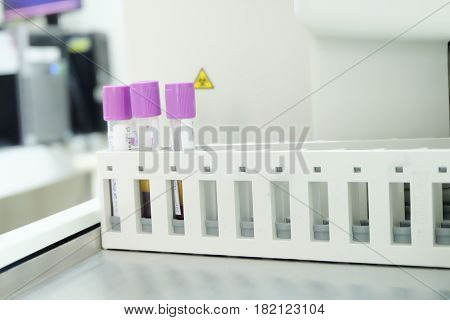 Test Tube Cbc Lab