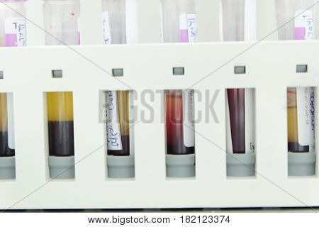 Test Tube Cbc Lab