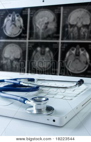 Medical Laptop