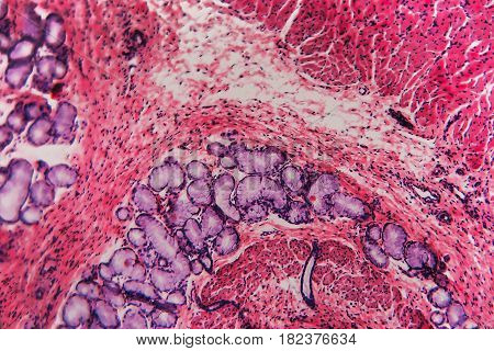 Esophagus Dog- Abstract Background Cell