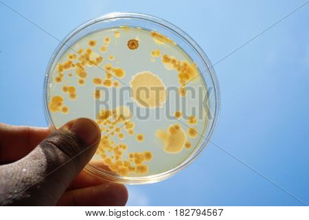 Colony of bacteria in culture medium plate Microbiology.