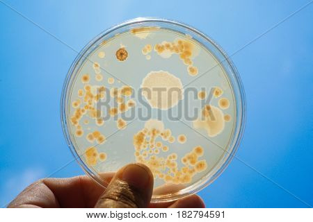 Colony of bacteria in culture medium plate Microbiology.