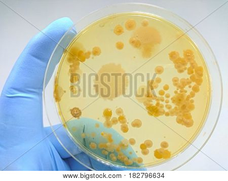Colony of bacteria in culture medium plate Microbiology.