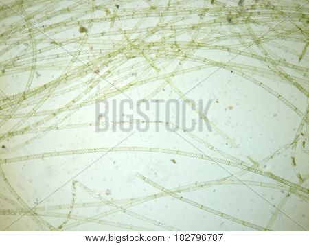 Filamentous algae are single algae cells that form long visible chains threads or filaments.