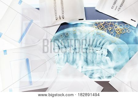 Many dental tools for braces including latex rings and clamps lay on xray jaw