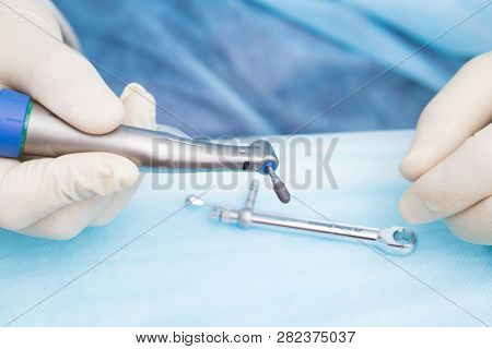 Close-up Dental Implant In The Hands Of A Dentist. An Implantation Surgery Is Underway. Titanium Imp