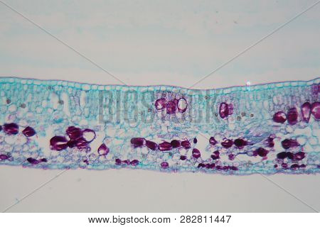 Cells Of A Plant Leaf With Damaged Epidermis And Chloroplasts Under A Microscope