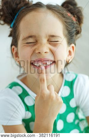 Little Girl With No Tooth. The Child Lost A Tooth. High Quality Photo.
