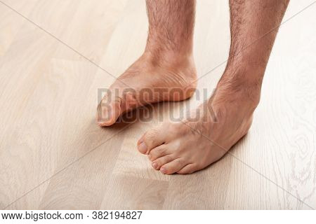 man doing flatfoot correction gymnastic exercise at home