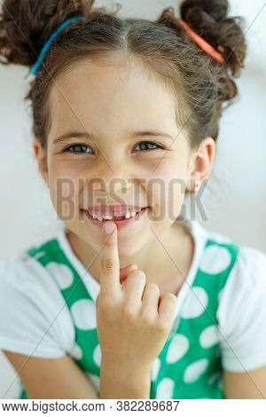 Little Girl With No Tooth. The Child Lost A Tooth. High Quality Photo.