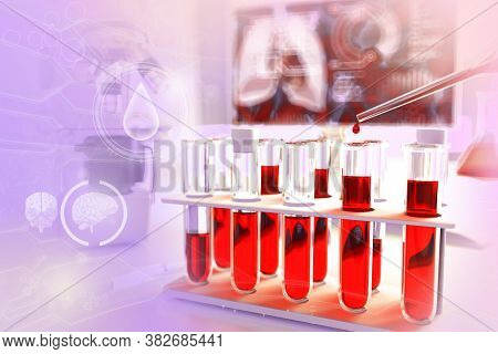 Proofs In Biotechnology Office - Blood Sample Dna Test For Amount Of Platelets Or Triglycerides, Med