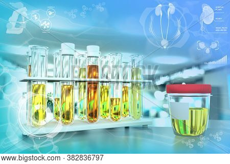 Test-tubes In Modern Science Study Facility - Urine Quality Test For Specific Gravity Or Bacteria, M