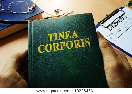 Hands holding book Tinea corporis. Medical concept.